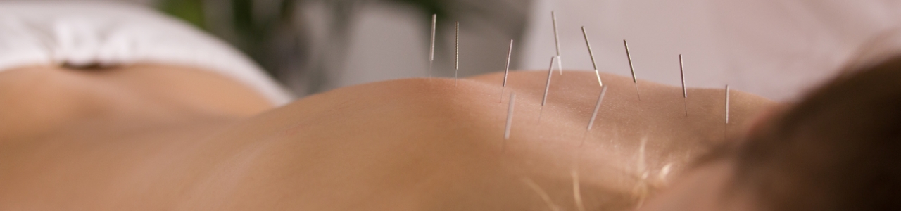 physical-therapy-clinic-dry-needling-novi-dpt-detroit-livonia-novi-mi