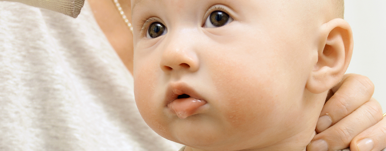 physical-therapy-clinic-pediatric-torticollis-novi-dpt-detroit-livonia-novi-mi